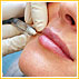 Botox - A Lunch-Time Treatment