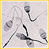 Frozen Sperm Can Be Used During ICSI