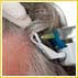 RegrowSure & StrongSure Scalp Therapy